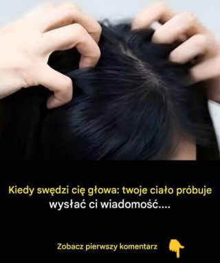 Swędząca skóra głowy? Oto najczęstsze przyczyny Zobacz pierwszy komentarz:
