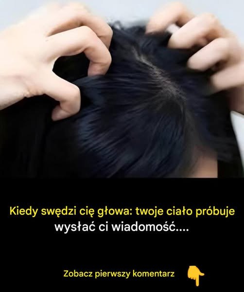 Swędząca skóra głowy? Oto najczęstsze przyczyny Zobacz pierwszy komentarz: