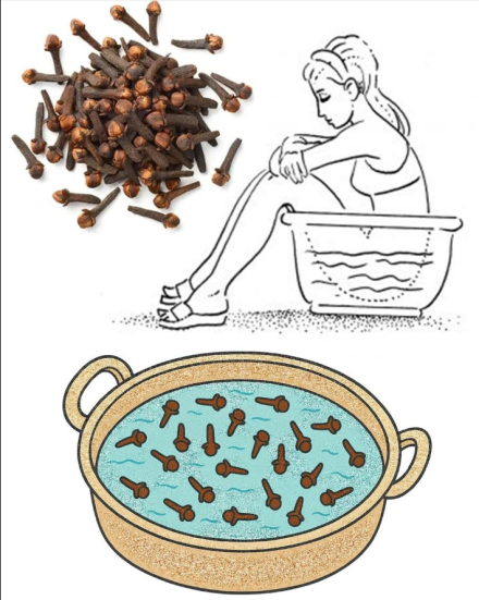 Kąpiele nasiadowe z wodą goździkową