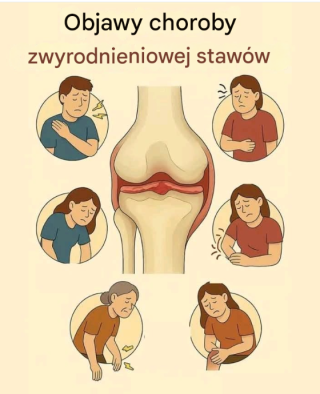 Objawy choroby zwyrodnieniowej stawów: co musisz wiedzieć