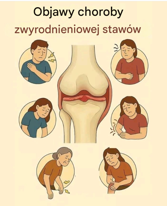 Objawy choroby zwyrodnieniowej stawów: co musisz wiedzieć