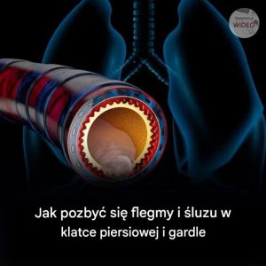Jak pozbyć się flegmy i śluzu w klatce piersiowej i gardle