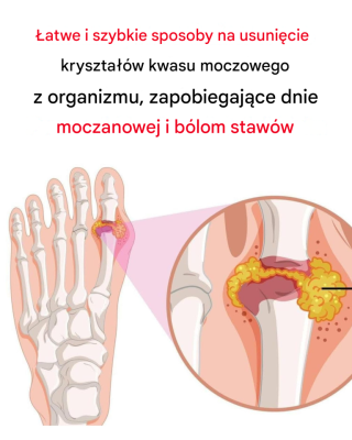 Jak naturalnie odwrócić dnę moczanową i złagodzić ból stawów