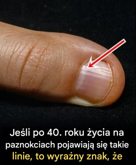 Najlepsze produkty spożywcze dla mocniejszych paznokci po 40. roku życia — jedz, aby mieć zdrowe i wytrzymałe paznokcie