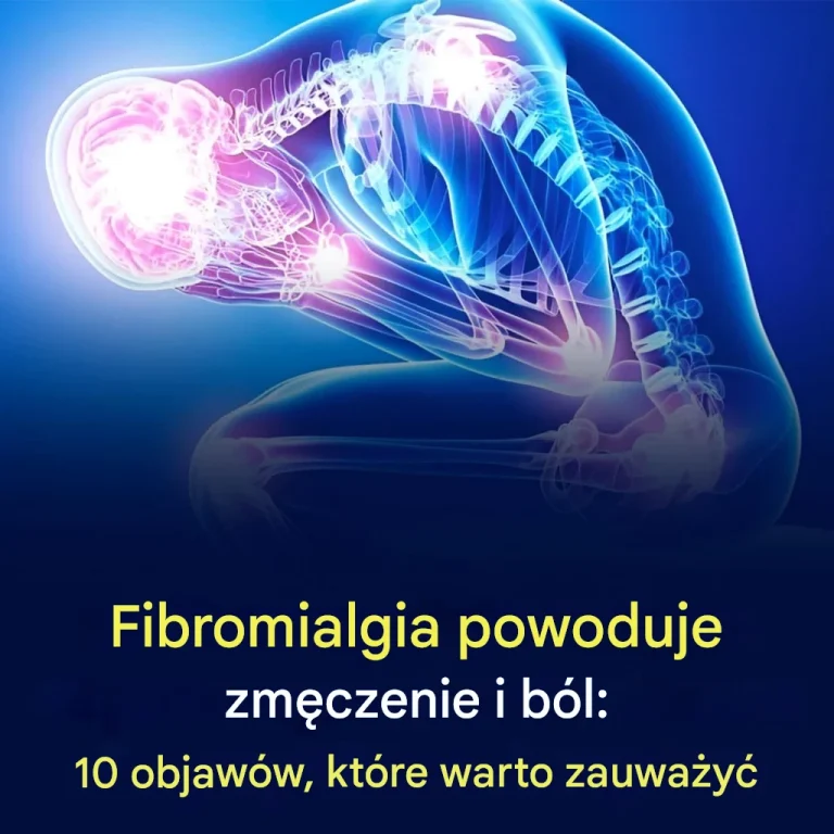 Objawy fibromialgii, które powinieneś znać